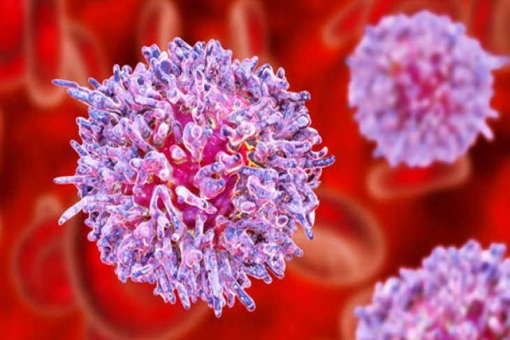 Tüylü Hücreli Löseminin 11 Belirtisine Dikkat!