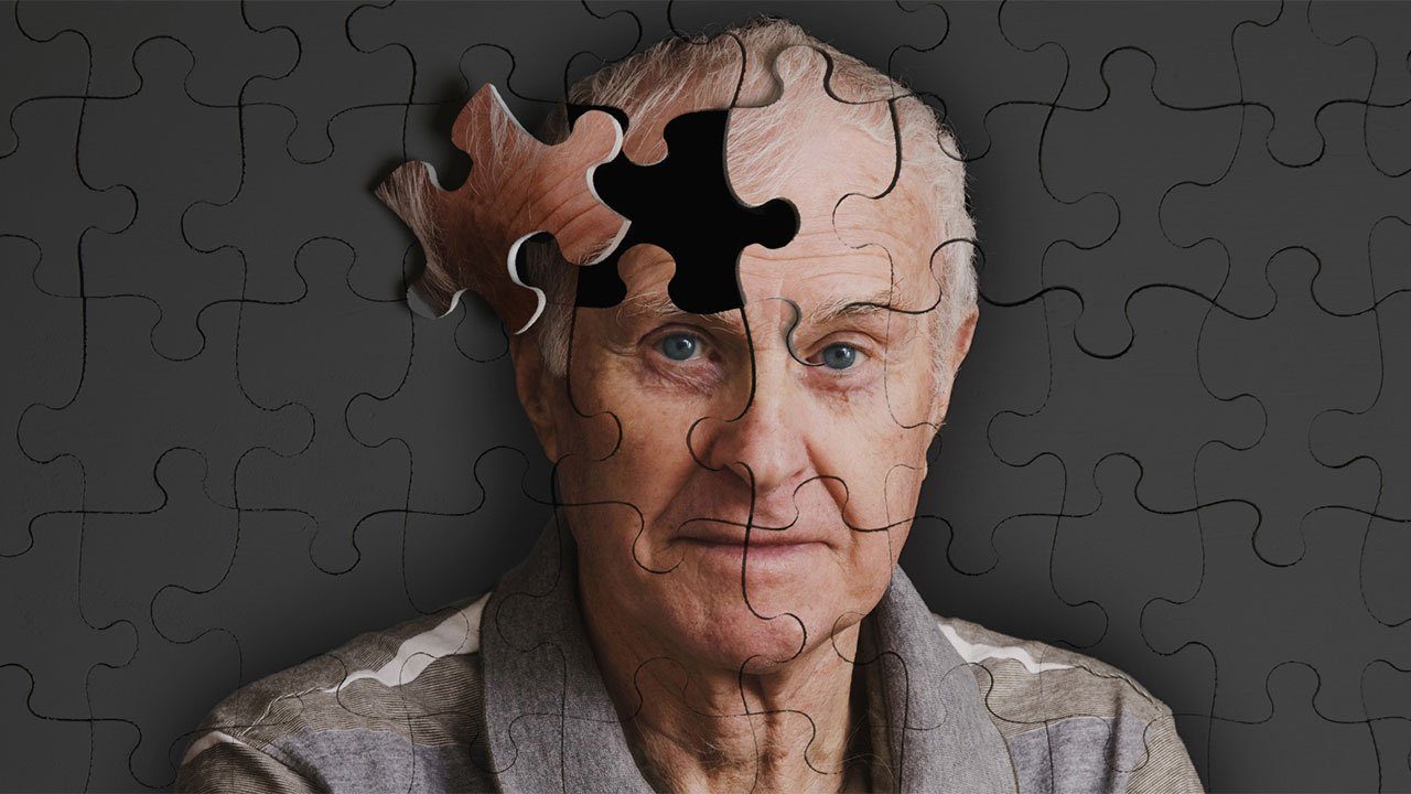 Alzheimer Veya Demans Riski