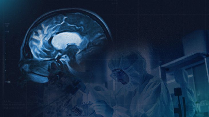 Alzheimer Tedavisinde Umut Veren Gelişme